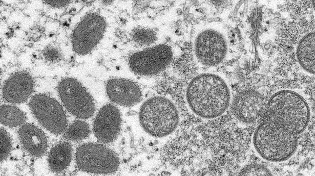 L’OMS demande l’aide de l’Inde pour tester les cas de monkeypox en Asie du Sud-Est