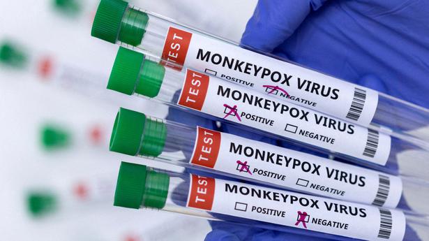 Two monkeypox strains in U.S. suggest possible undetected spread