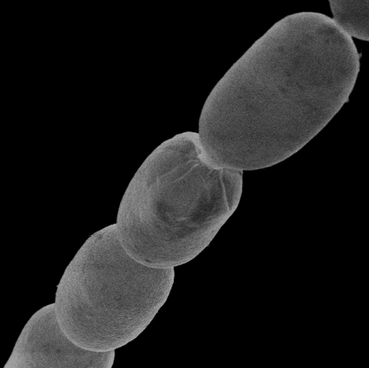 यह माइक्रोस्कोप फोटो थियोमार्गरीटा मैग्नीफिका बैक्टीरिया सेल का हिस्सा दिखाता है।