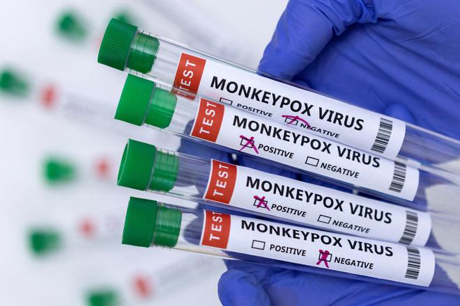 
The monkeypox virus: origins and outbreaks 
