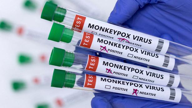 780 cases of monkeypox reported or identified as of June 2: WHO