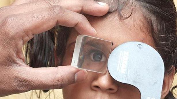 Ophthalmologists flag sharp rise in myopia among children