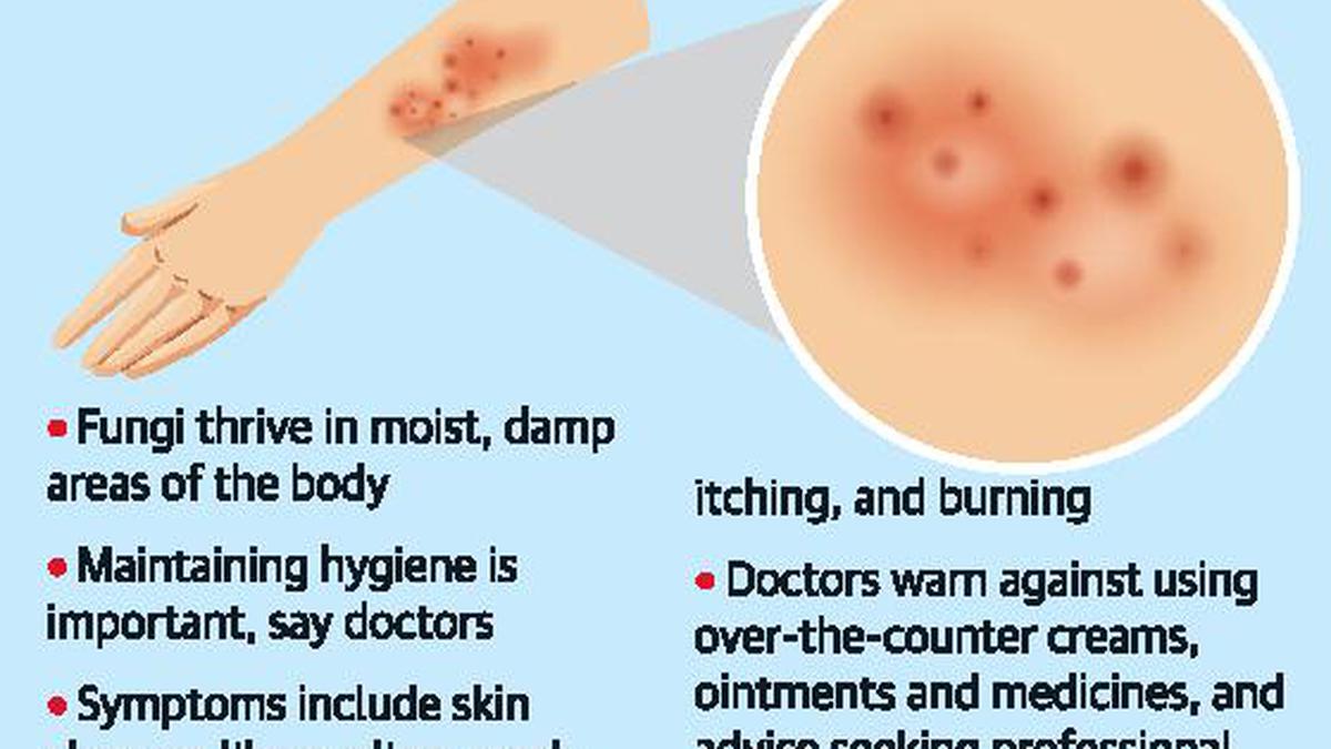 Skin Fungal Infection Images | Skin Review Site