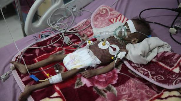 UN: In war, 16 million Yemenis 'marching' toward starvation
