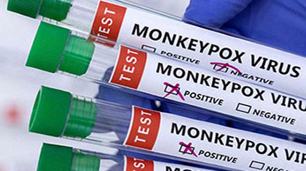 Le ministère de la Santé publie des normes pour lutter contre le monkeypox
