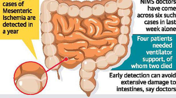 Cases of near-fatal intestinal damage up