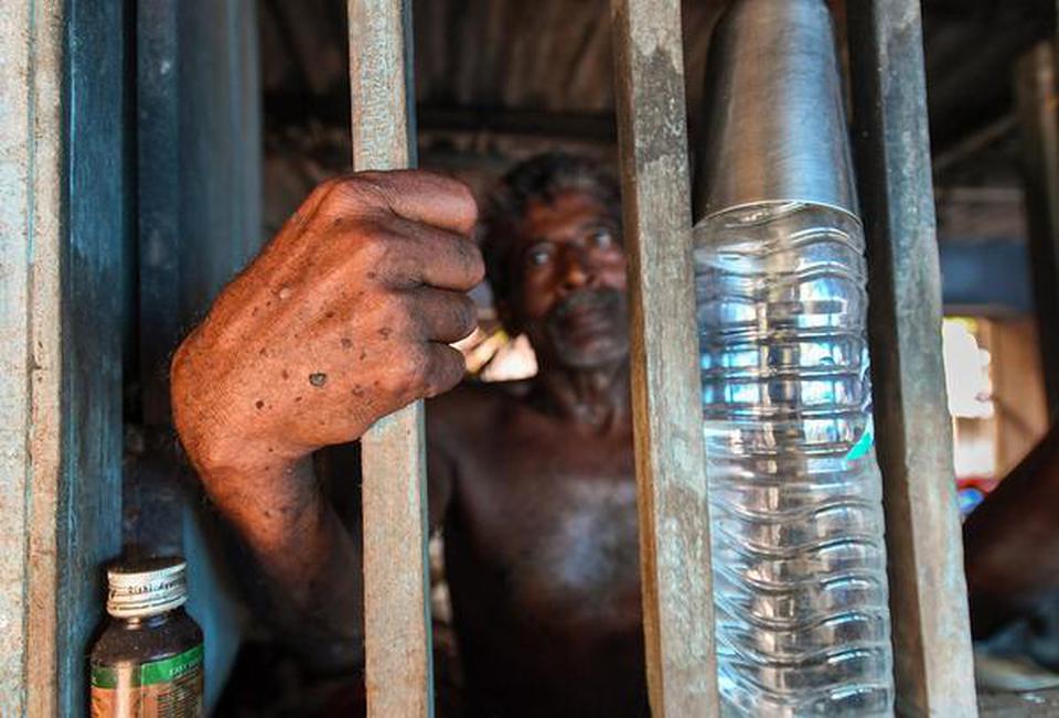 Monotosh Biswas, a 65-year-old farmer, has been suffering from arsenicosis for over two decades